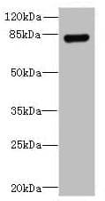 Polyclonal Rabbit anti-Human Trimethylguanosine Synthase 1 Antibody (aa713-853, IHC)