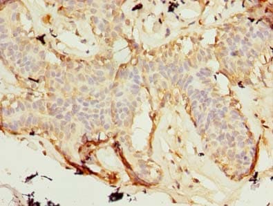 ZNF19 Antibody