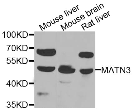 MATN3 / Matrilin 3 Antibody