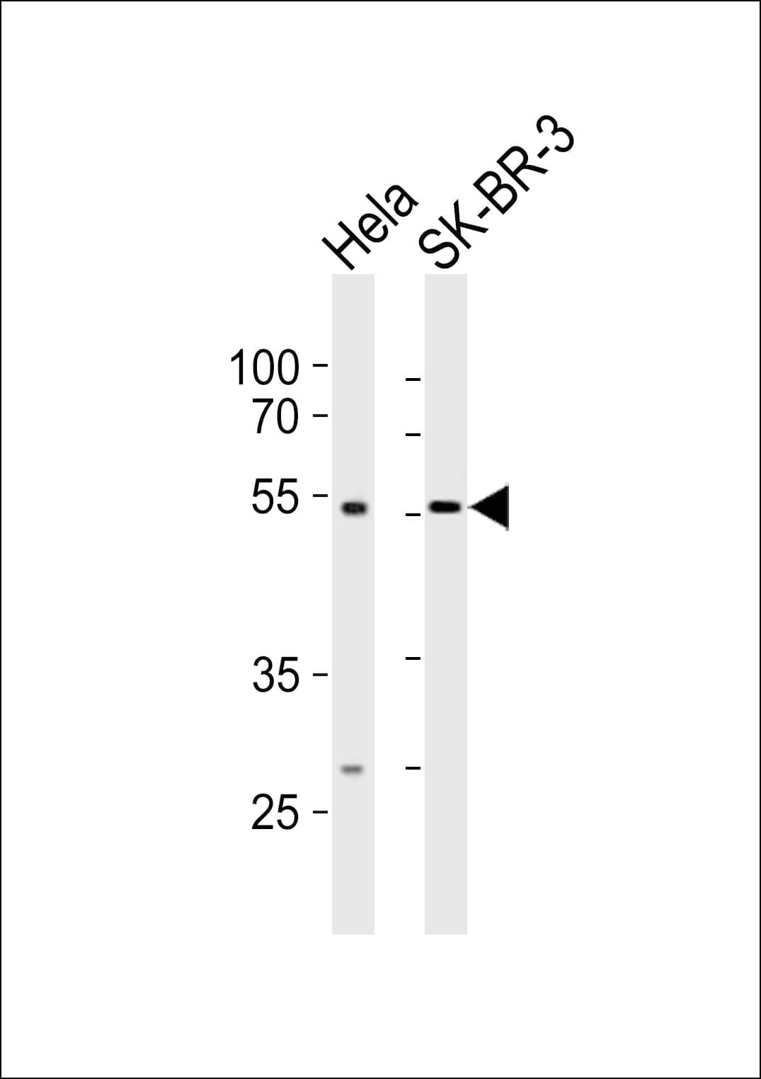 Polyclonal Rabbit anti-Human SMARCE1 / BAF57 Antibody (aa327-361, WB)