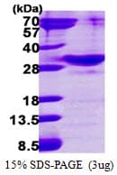 Human RAB34 Protein (Recombinant His)