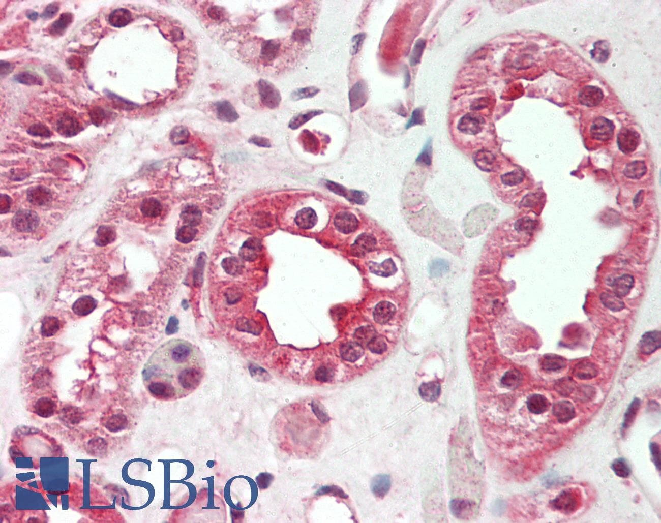 Polyclonal Rabbit anti-Human SOST / Sclerostin Antibody (aa38-87, IHC, WB)