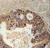 DYRK / DYRK1A Antibody (aa107-136)