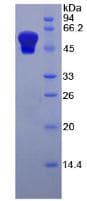 Human HAVCR1 / KIM-1 Protein (Recombinant His-GST)