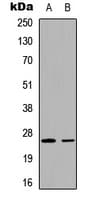 UBTD2 Antibody (C-Terminus)