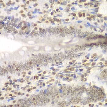 NIRF / UHRF2 Antibody