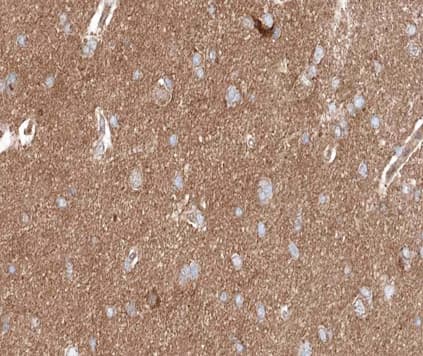 Polyclonal Rabbit anti-Human PRKCD / PKC-Delta Antibody (phospho-Ser645, IHC, IF, WB)