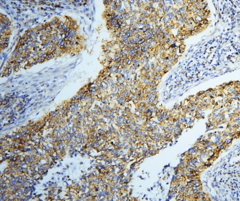 Polyclonal Rabbit anti-Human DARS2 Antibody (IHC, WB)