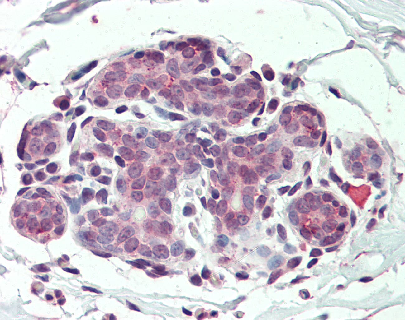 IHC-plus™ ITGA6/Integrin Alpha 6/CD49f Antibody (N-Terminus)