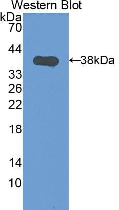 KRT1 / CK1 / Cytokeratin 1 Antibody (aa189-497, Cy3)
