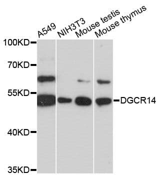 Polyclonal Rabbit anti-Human DGCR14 Antibody (WB)