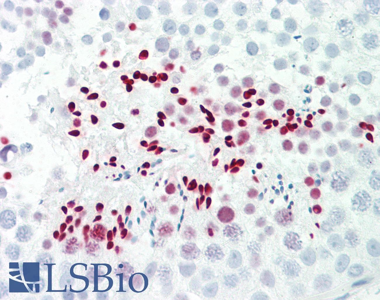 IHC-plus™ LDOC1L Antibody (aa141-190)
