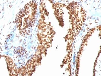Monoclonal Mouse DNA ds Antibody (clone AE-2, IHC)