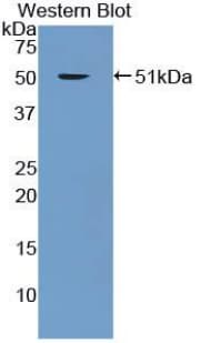ENO1 / Alpha Enolase Antibody (APC)