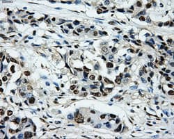 PKMYT1 Antibody (clone OTI5E1)