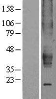 ESRRB / ERR Beta Protein (Over-Expression Lysate Myc-DDK (Flag))