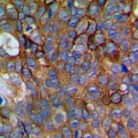 NCALD / Neurocalcin Delta Antibody (Internal)
