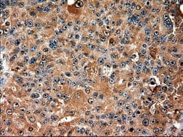 TRIM33 / TIF1-Gamma Antibody (clone OTI9D4)