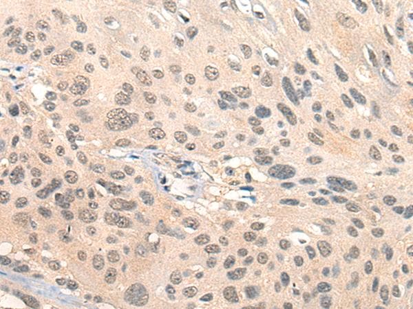 HIPK2 Antibody