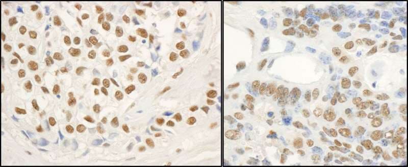 FUS / TLS Antibody (aa500-C-term)