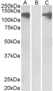 IHC-plus™ PUM2 Antibody (aa141-155)