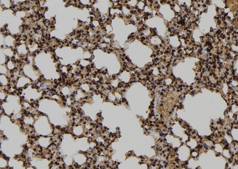 TUBD1 / Tubulin Delta Antibody