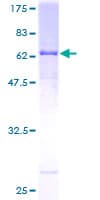 Human REN / Renin 1 Protein (Recombinant GST)
