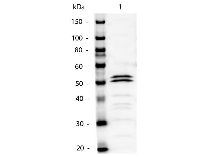 Polyclonal Rabbit Anti-Mouse IgG1 Secondary Antibody (AP, IHC, WB)