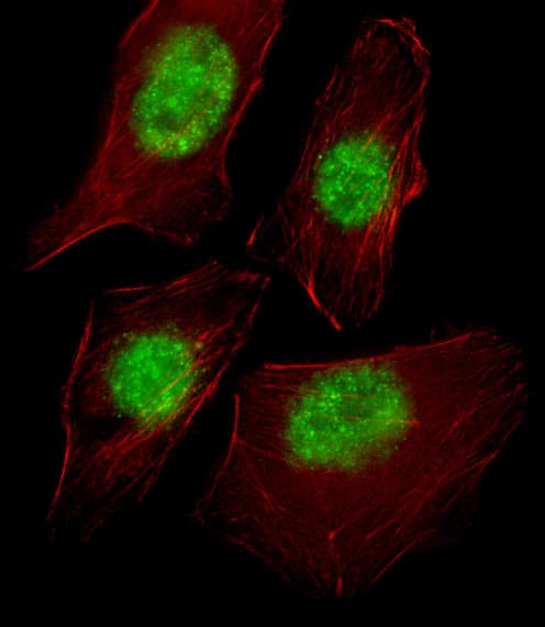 TAF9 Antibody (aa1-30)