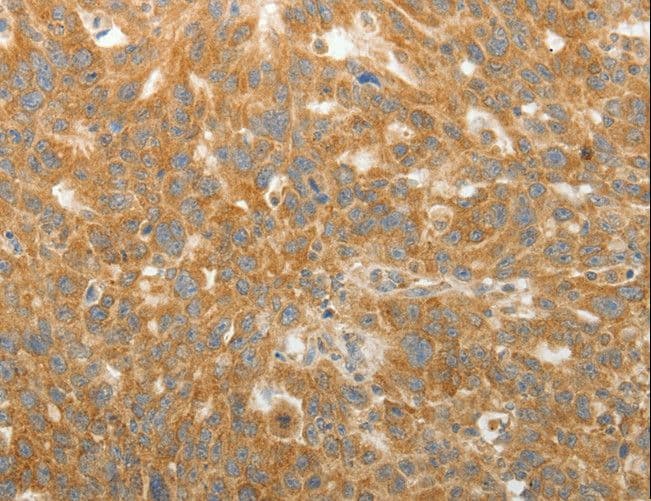 Polyclonal Rabbit anti-Human SIP1 Antibody (IHC)