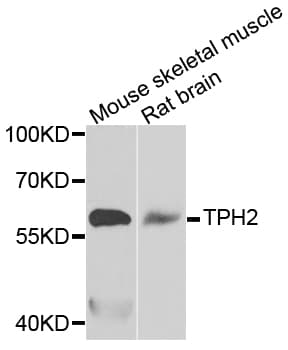 TPH2 Antibody