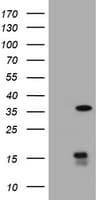 TS / Thymidylate Synthase Antibody (clone OTI1C3)