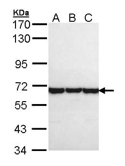Polyclonal Rabbit anti-Human CCT8 Antibody (aa111-367, IHC, WB)