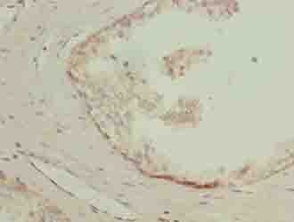LYSMD1 Antibody
