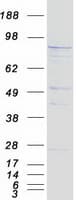 Human TELO2 Protein (Recombinant Myc-DDK (Flag))