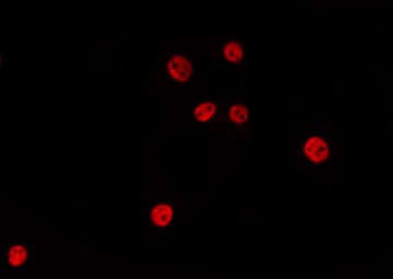 RANBP6 Antibody