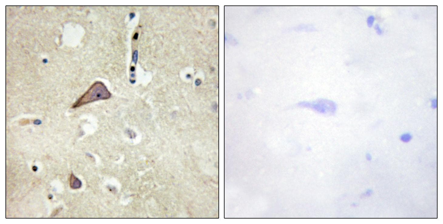 Polyclonal Rabbit anti-Human GRIN1 / NMDAR1 Antibody (phospho-Ser896, IHC, WB)