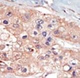 Polyclonal Rabbit anti-Human UHMK1 / KIS Antibody (aa1-30, IHC, WB)