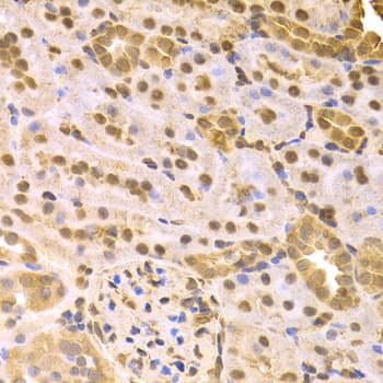 Polyclonal Rabbit anti-Human MAP2K7 / MEK7 Antibody (IHC, IF, WB)