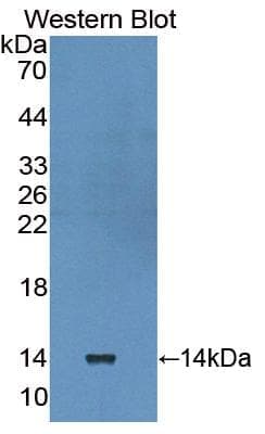 LAMB3 / Laminin Beta 3 Antibody (aa30-222)