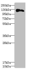 Polyclonal Rabbit anti-Human Anillin Antibody (IHC, WB)