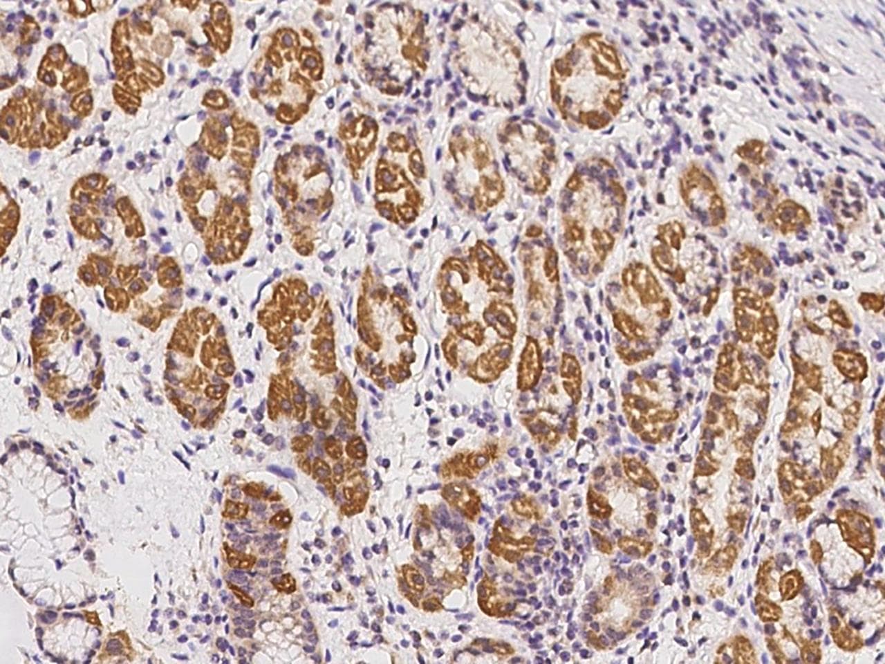 TAPT1 Antibody