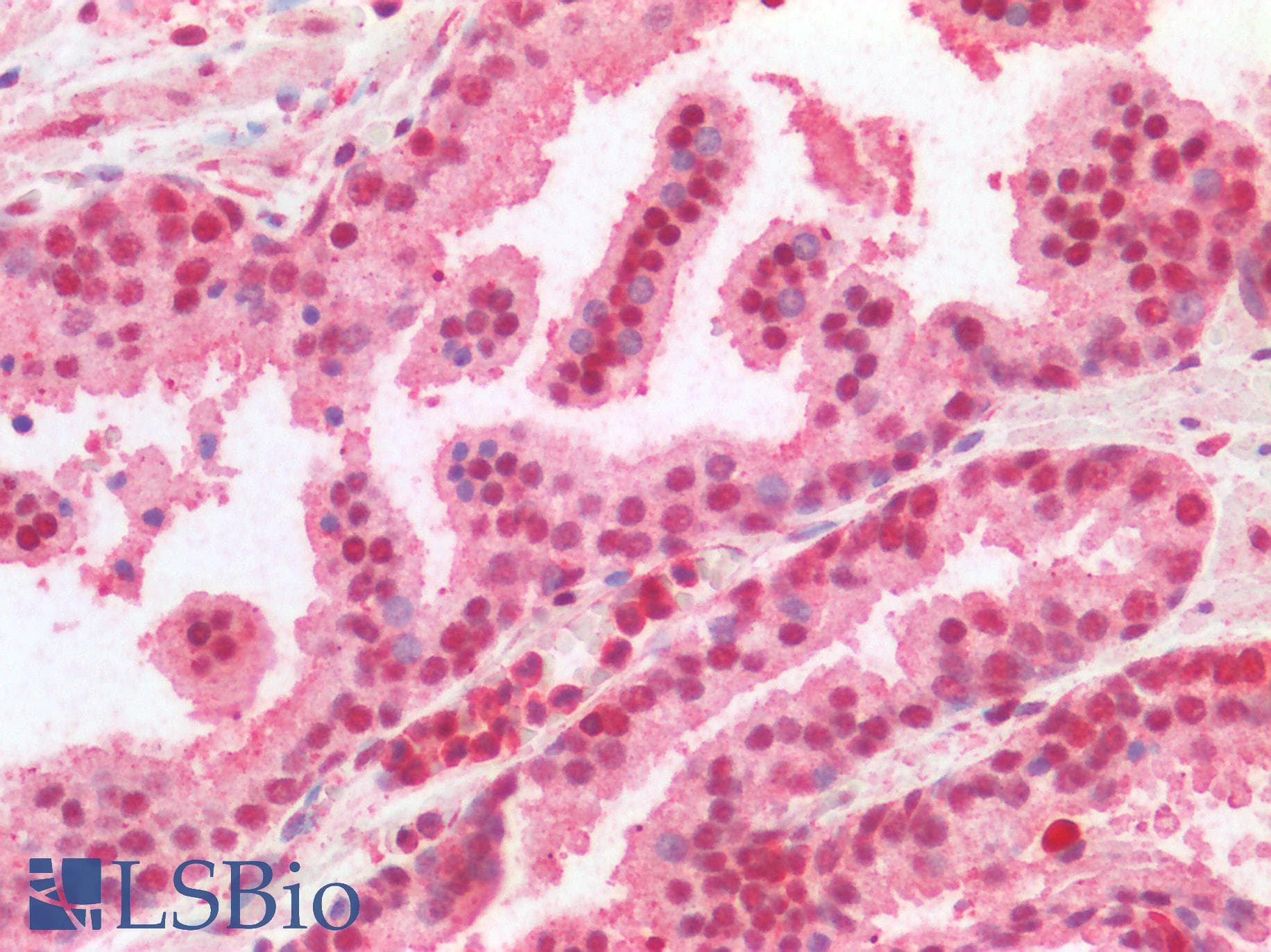 IHC-plus™ Polyclonal Goat anti-Human CREB1 / CREB Antibody (aa96-109, IHC, WB)