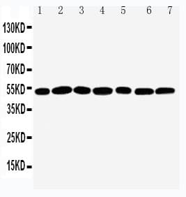 Polyclonal Rabbit anti-Human CTBP2 Antibody (aa429-445, IHC, WB)