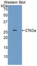 CDK5 Antibody (aa92-273, Cy3)
