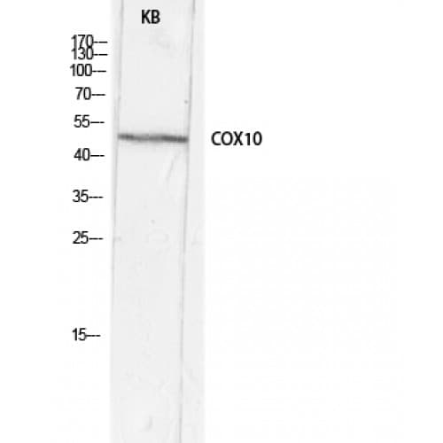 COX10 Antibody (Internal)