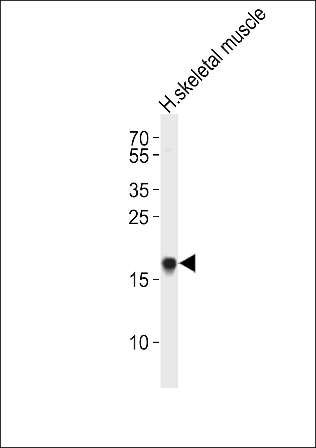 SIP / TP53INP1 Antibody (aa36-64)