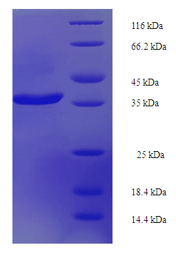 Human IFT22 / RABL5 Protein (Recombinant His-SUMO)