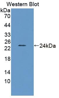 LEPR / Leptin Receptor Antibody (aa22-203)