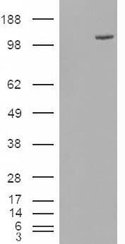 IHC-plus™ Polyclonal Goat anti-Human ESYT1 Antibody (aa1038-1050, IHC, WB)